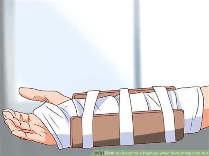 【How-to】How to Check for a Fracture when Performing First Aid