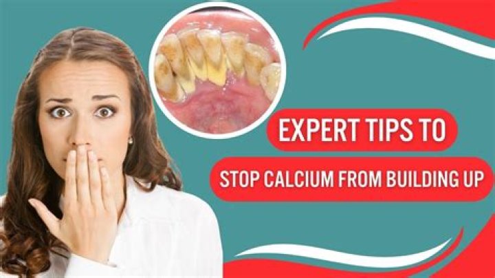 【How-to】How to get rid of calcium deposits on teeth
