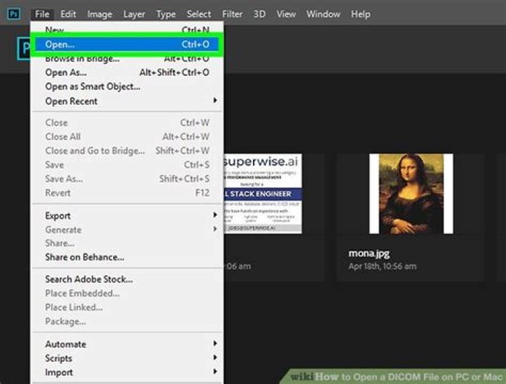 【How-to】How to Open a DICOM File on PC or Mac