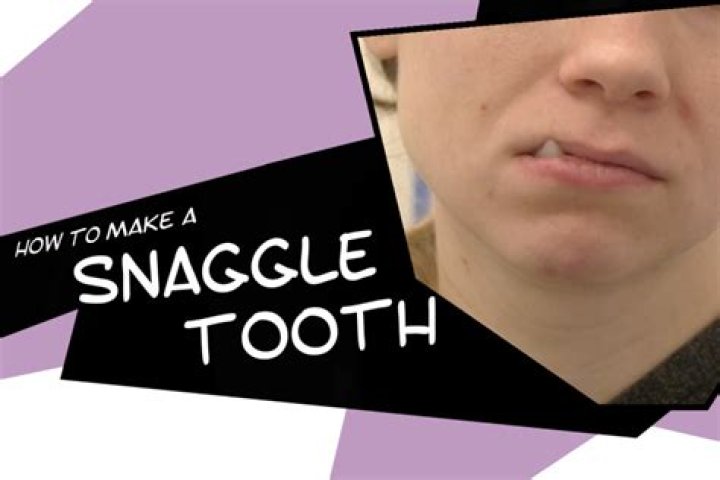 【How-to】What is a snaggle tooth