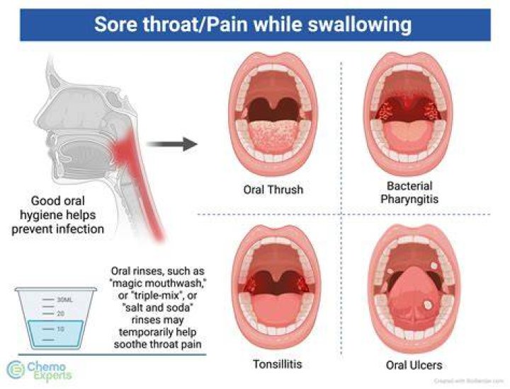 【How-to】Why does my throat hurt when i yawn