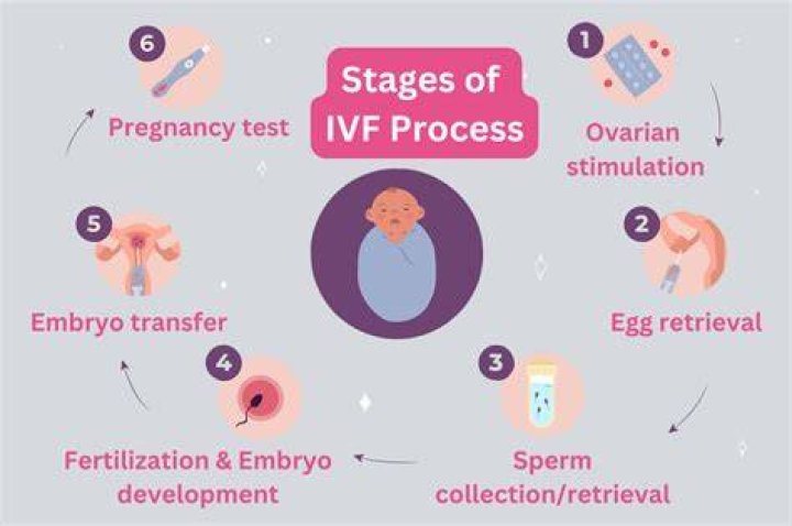 Is IVF free in Germany?