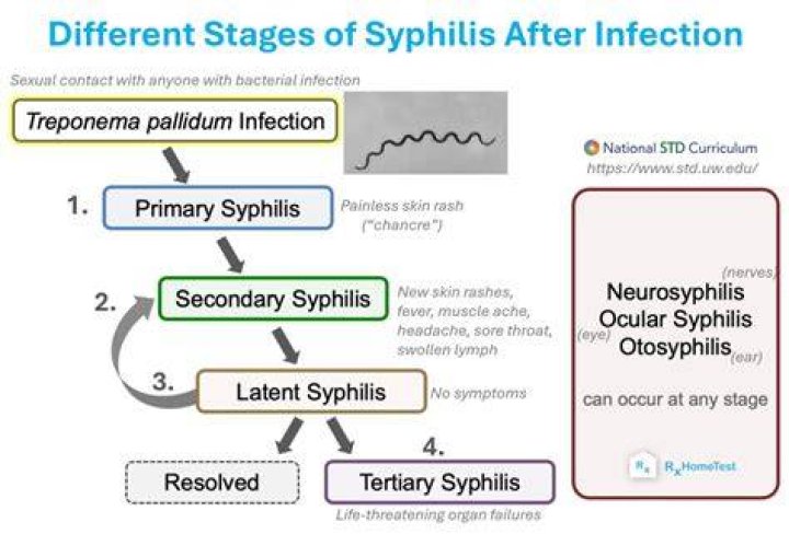 Is leprosy a syphilis?