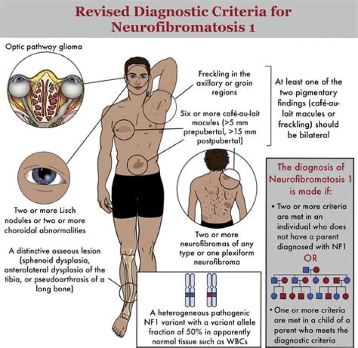 Is NF1 fatal?