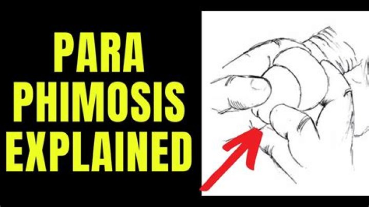 Is pulling back foreskin painful?