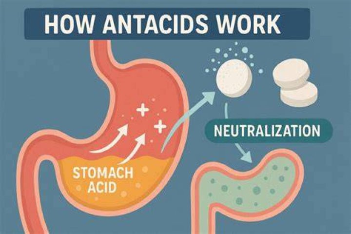 Should I take antacid for gastritis?