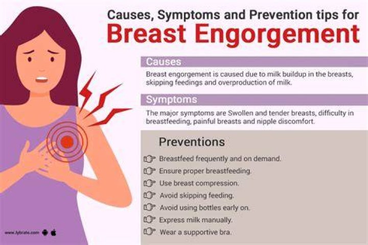 Should I wake my baby to feed if my breasts are engorged?