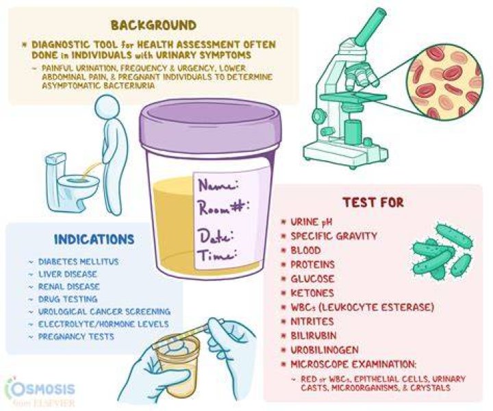 What are the abbreviations on a urine test?