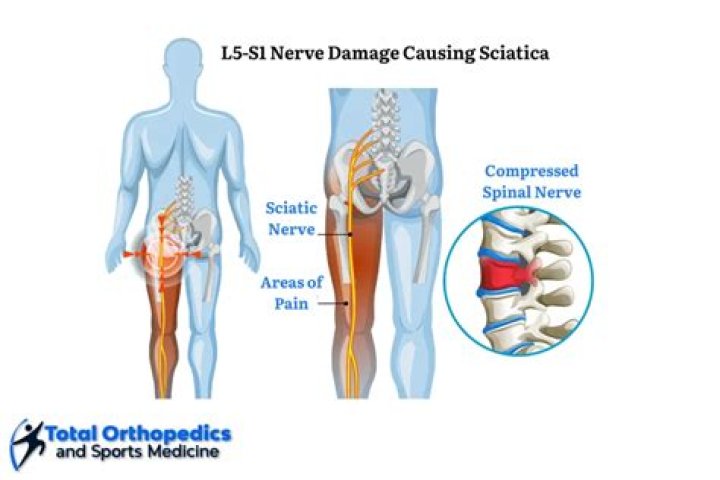 What are the symptoms of nerve damage in the lower back?