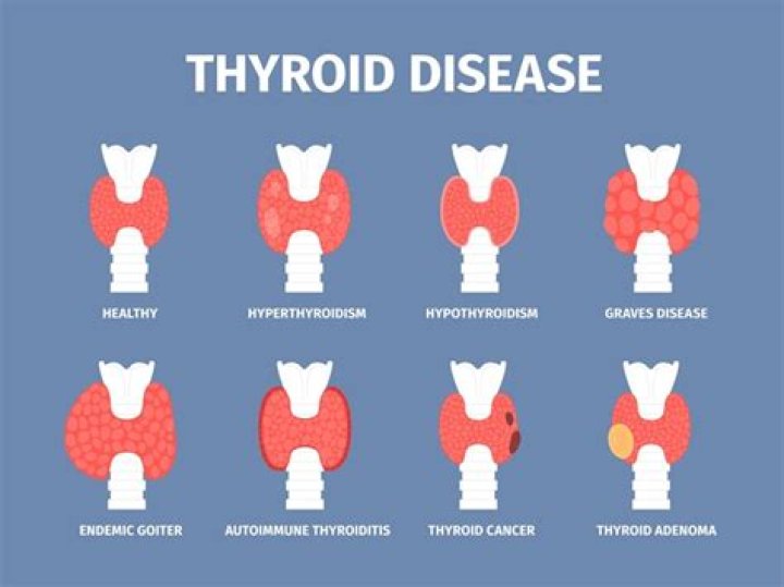 What are the two thyroid conditions?