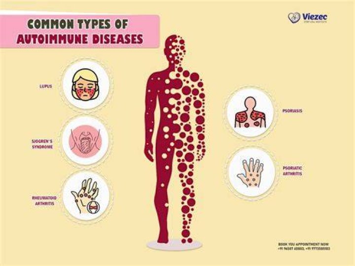 What autoimmune diseases cause Meniere's disease?