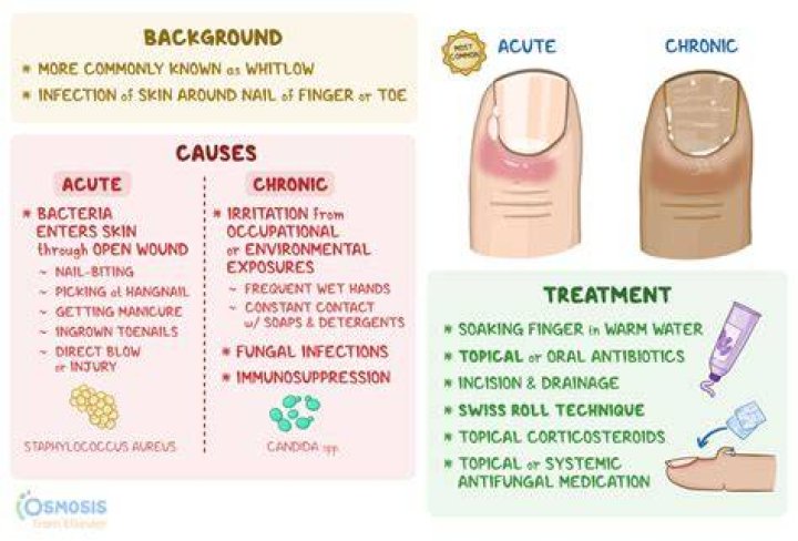 What causes cuticle infection?