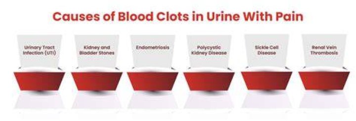 What causes small blood clots in urine?