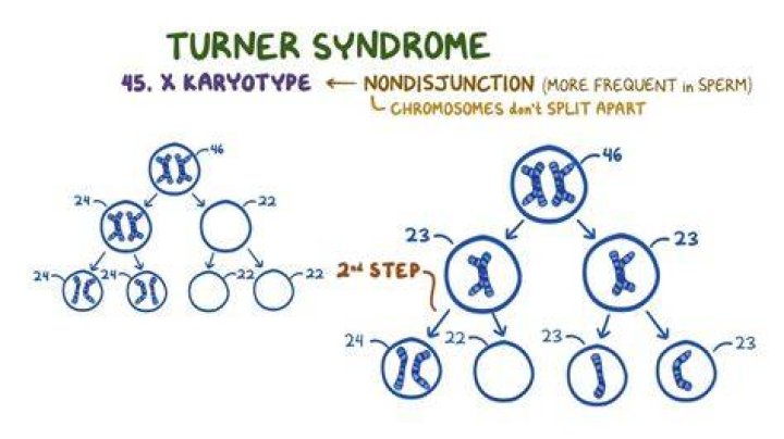 What causes Turner's tooth?