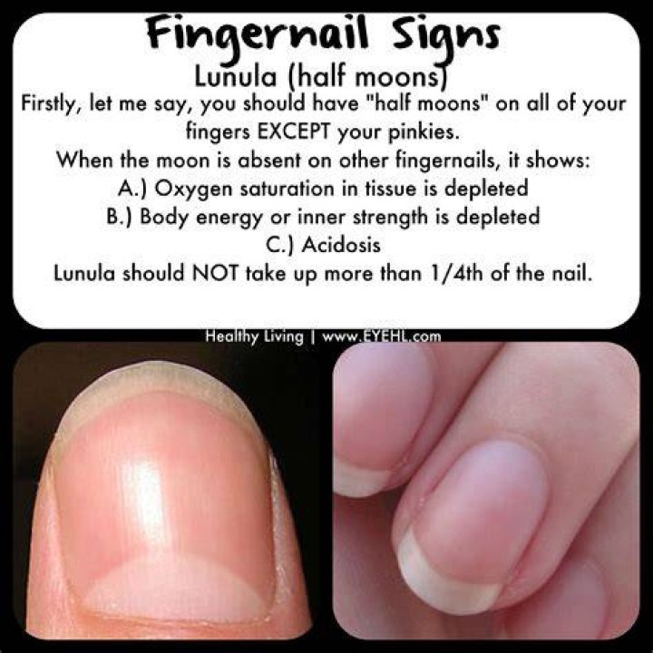 What do moons on fingernails mean?