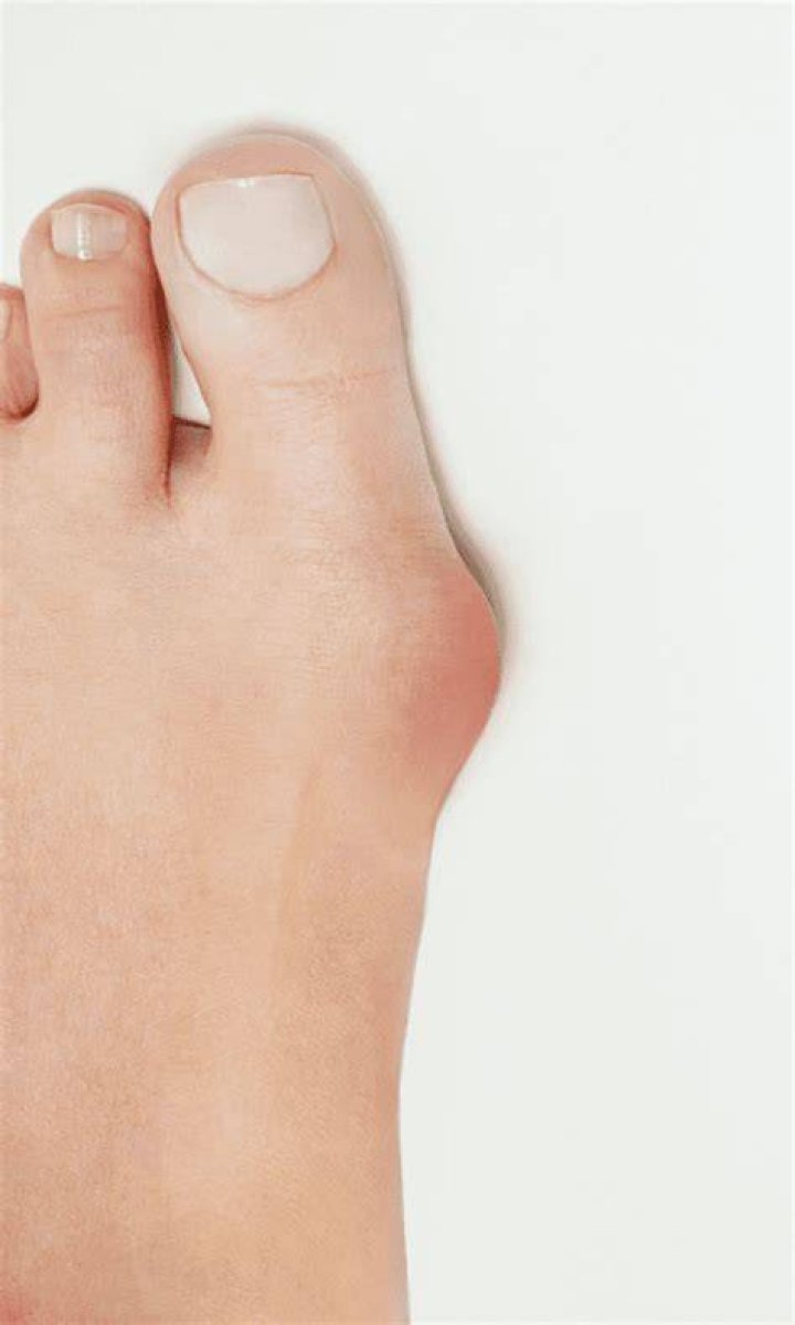 What does a dislocated toe feel like?