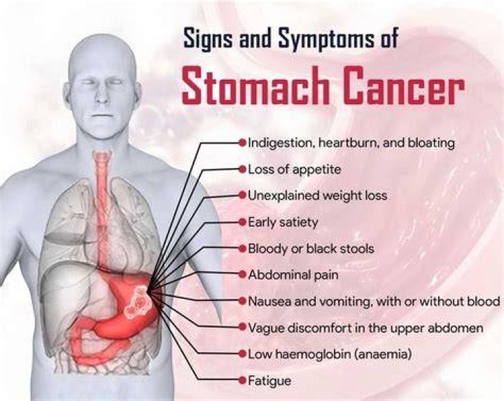 What does an abdominal mass feel like?