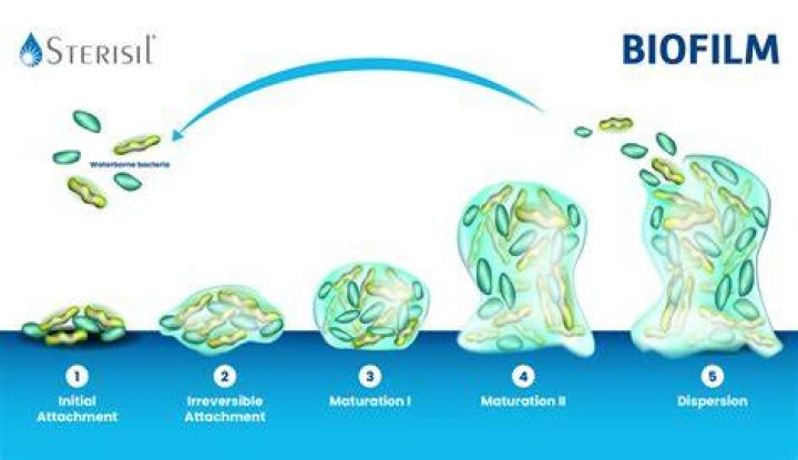 What does biofilm feel like?