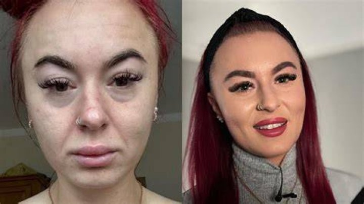 What drug do they give you before surgery?