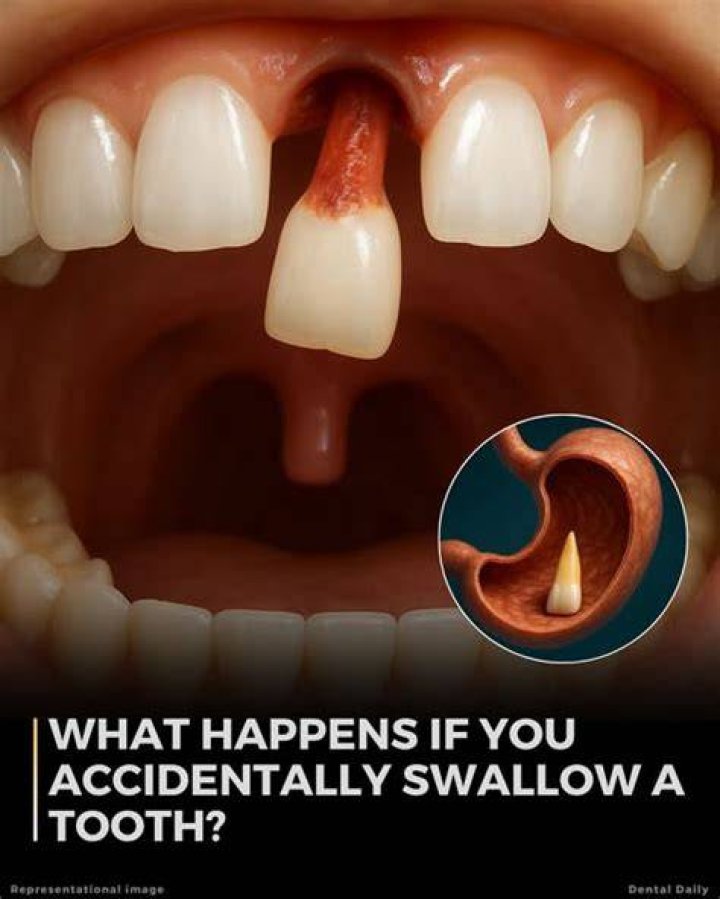 What happens if you swallow your tooth?