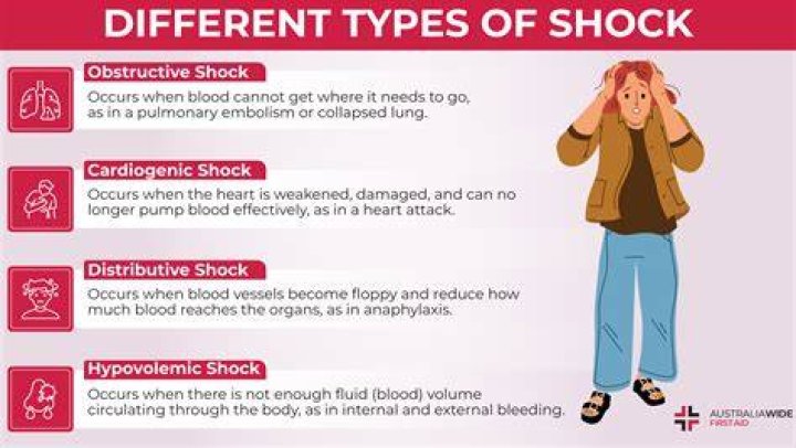 What is a nasty shock?