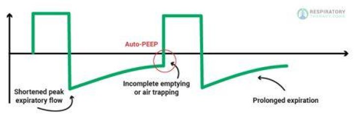 What is AutoPEEP?