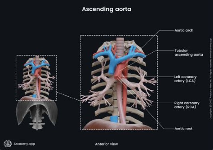 What is deceptive aorta?