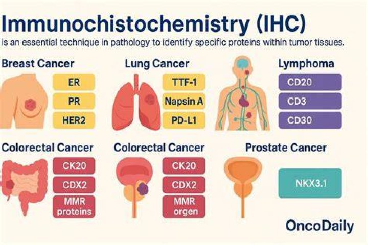 What is IHC used for?