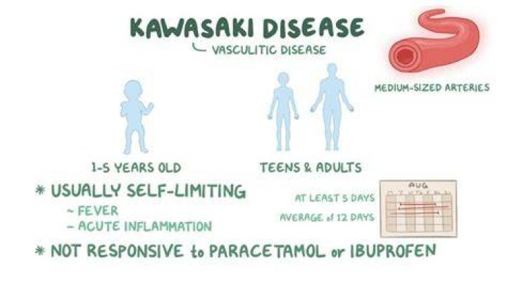 What is Kawasaki disease in adults?