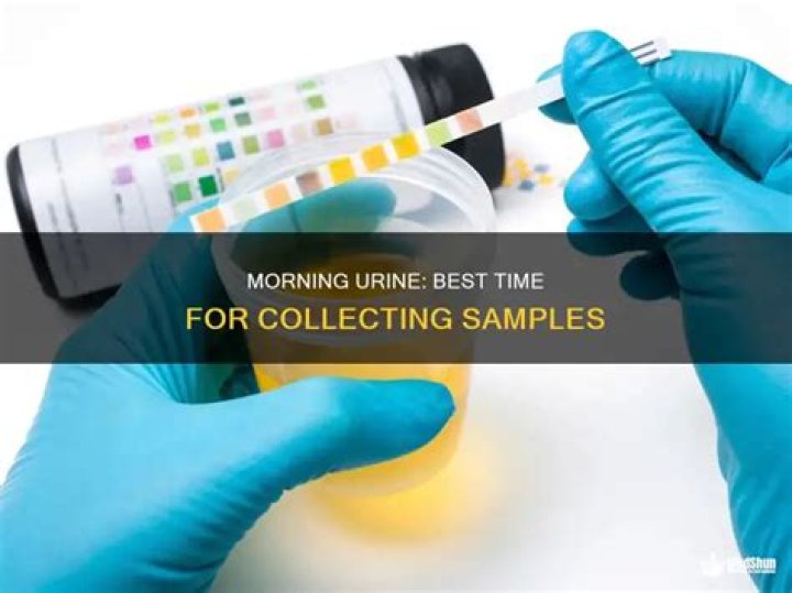 What is the best time to collect urine sample?