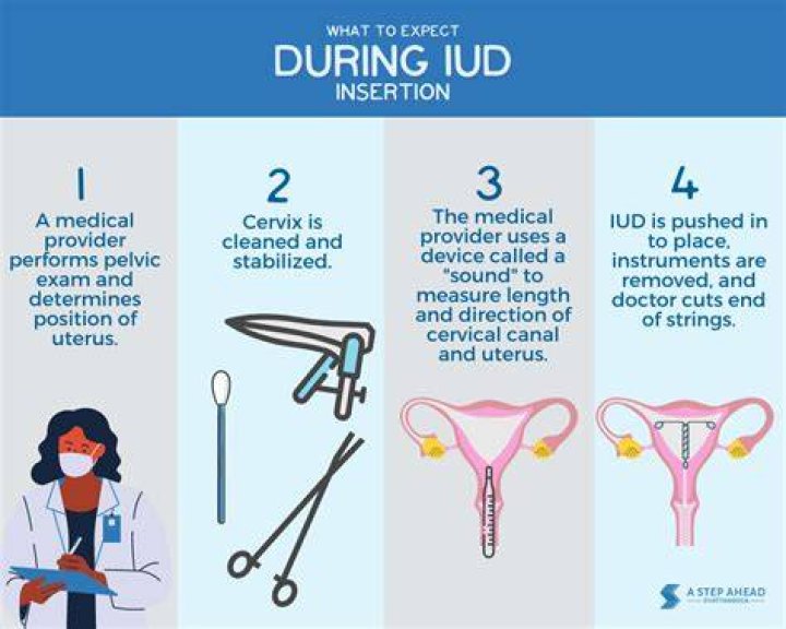What is the least painful way to insert an IUD?