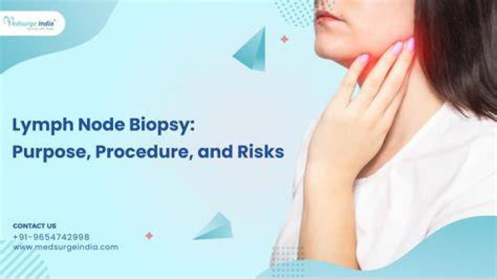 What kind of doctor does lymph node biopsy?