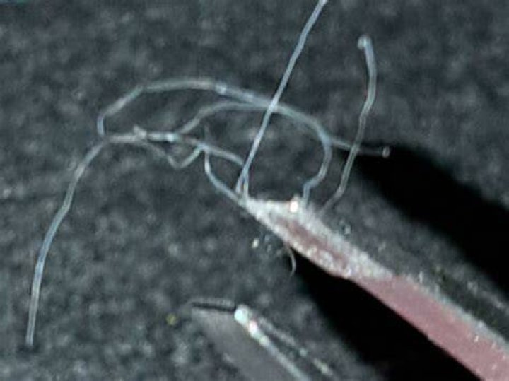 What parasite looks like white hair?