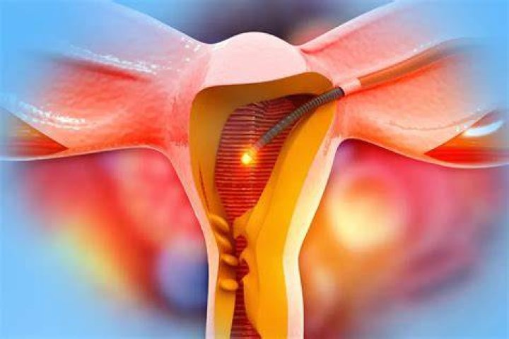 When can I be passenger in car after hysterectomy?