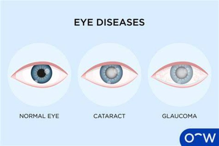 Where do you go for eye problems?