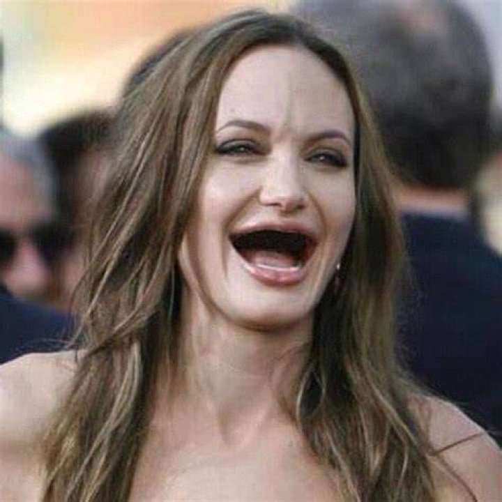 Which celebrities have no teeth?