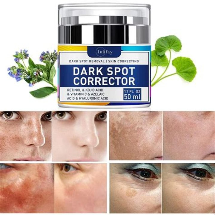 Which cream is best for removing dark spots on face?