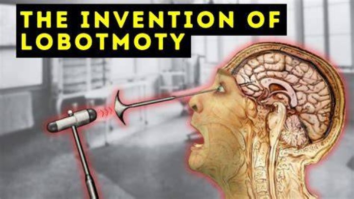 Who invented the lobotomy?