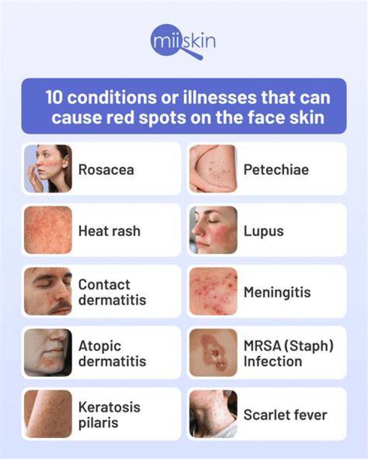 Why am I getting red dots on my face?