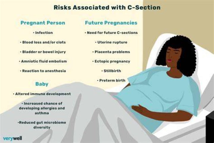 Why C-section is not good?