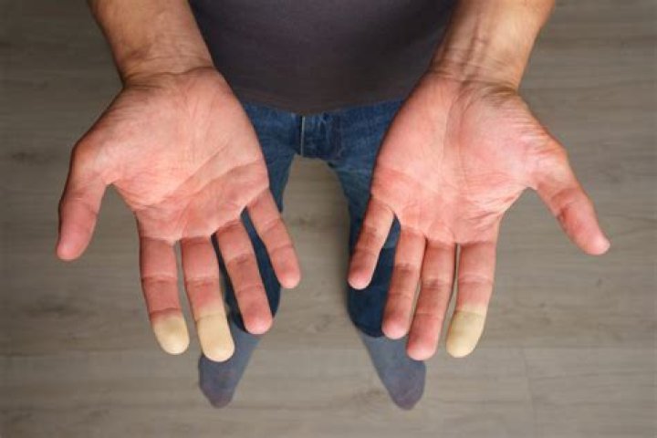 Why did my hand give out?