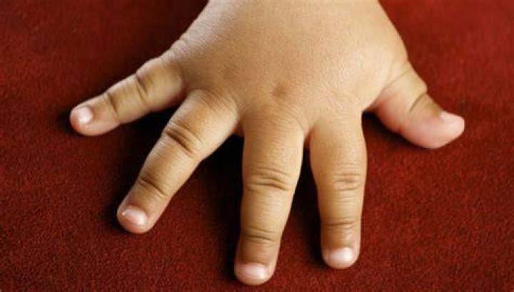 Why do I have chubby fingers?