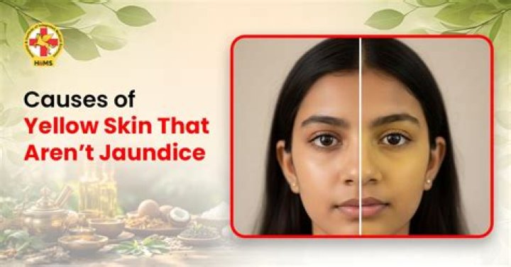 Why does my skin look yellow Not jaundice?