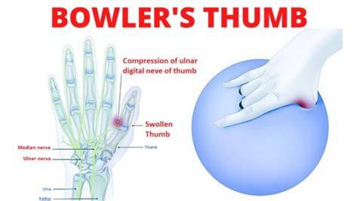 Why does my thumb stick in my bowling ball?