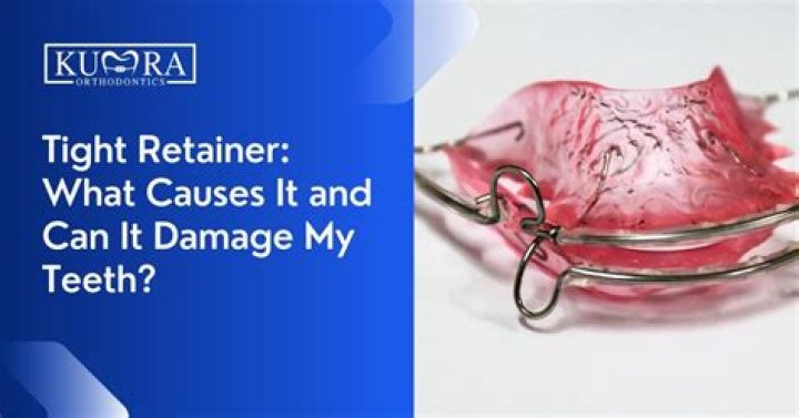 Why does retainer hurt so much?