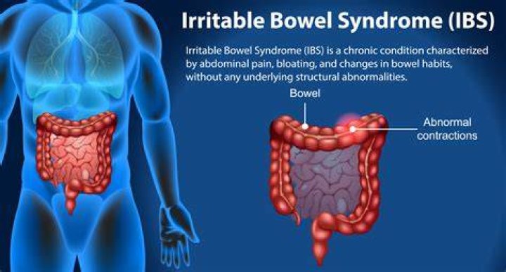 Why is my IBS worse when I am stressed?