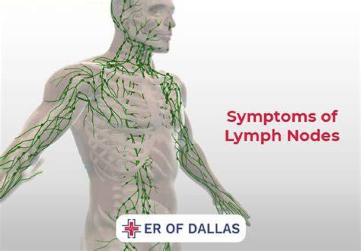 Why is my lymph node huge?