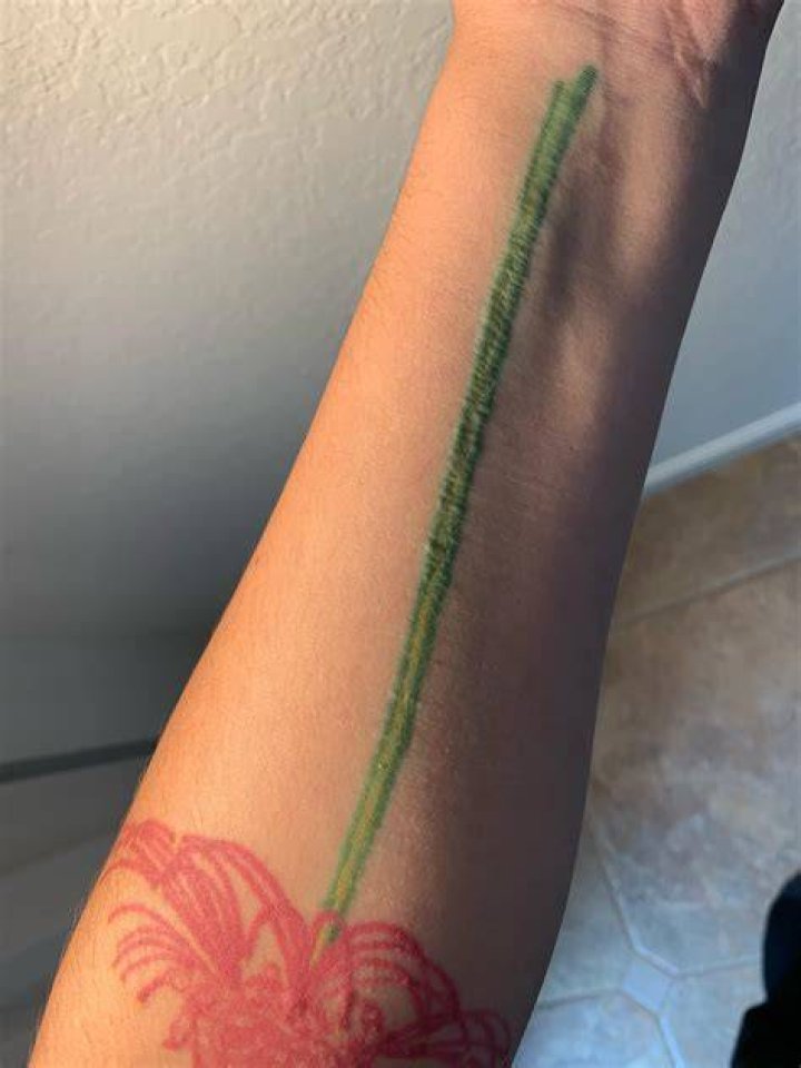 Why is my tattoo bumpy after a year?