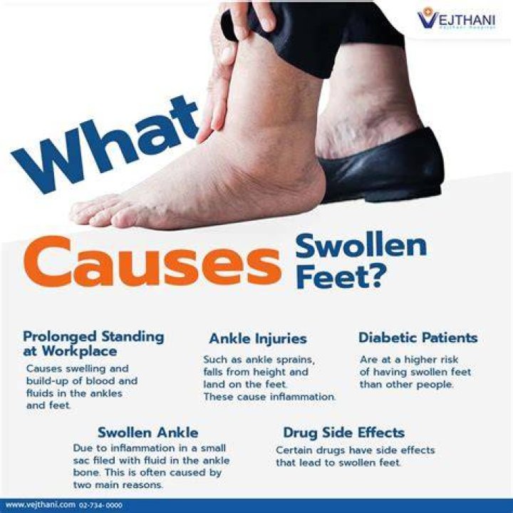 Why won't my ankle swelling go down?