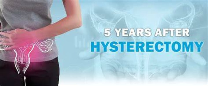Will I look old after hysterectomy?